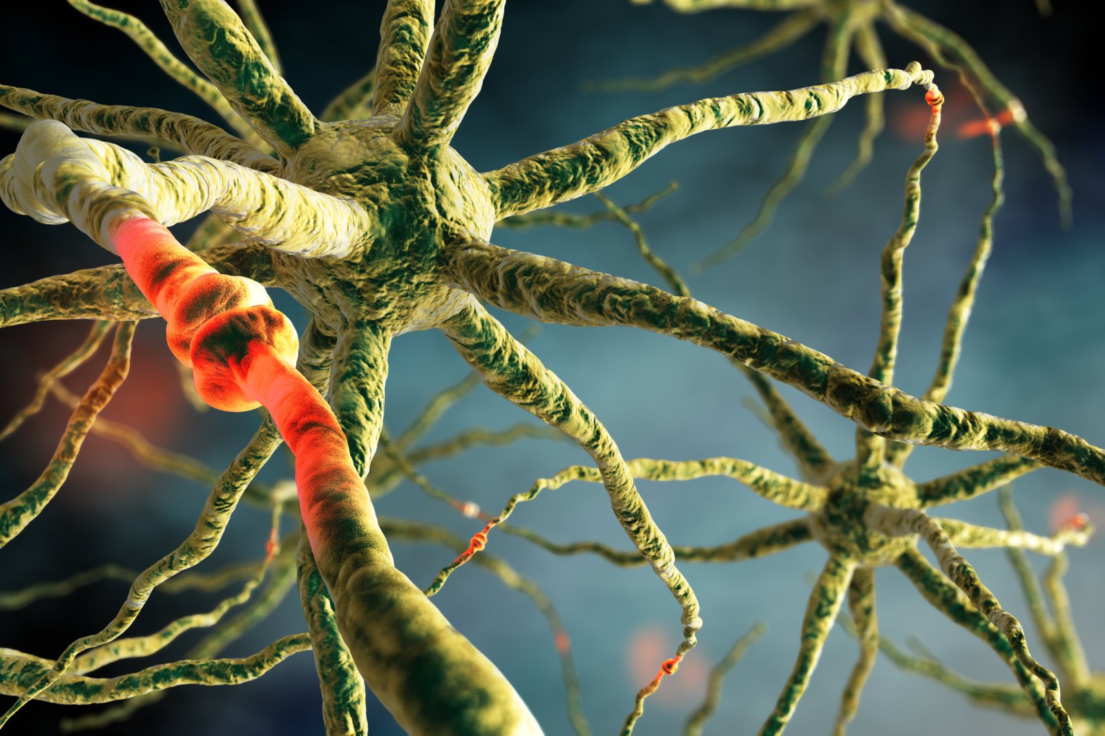 ტვინის მსგავსი კომპიუტერები რეალობა გახდება